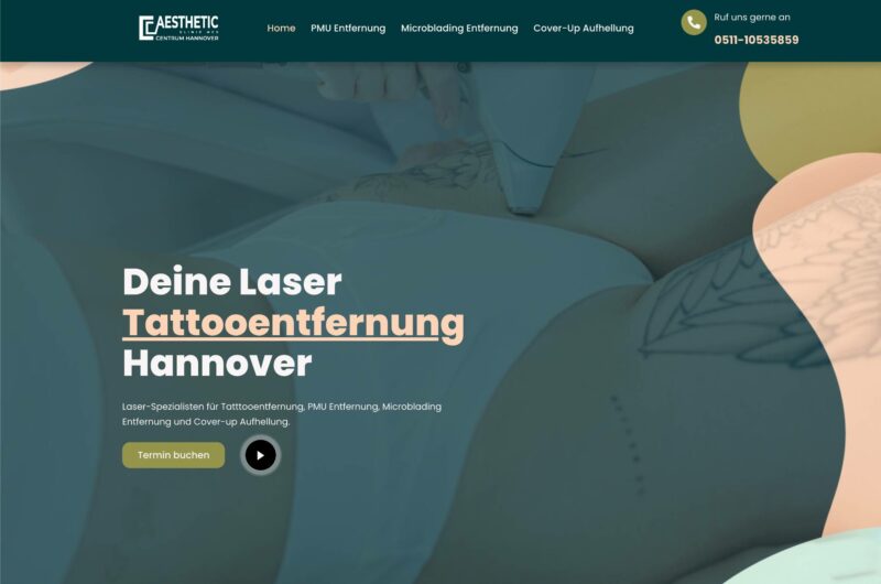 Deine Laser Tattooentfernung Hannover